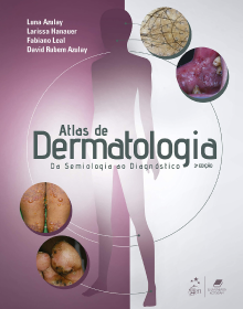 Livro recomendado Atlas de Dermatologia: Da Semiologia ao Diagnóstico