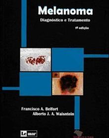 Livro recomendado Melanoma: Diagnóstico e Tratamento